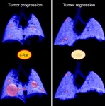 Científicos logran inducir la regresión de tumores de pulmón en ratones