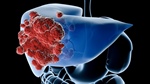 Nueva diana terapéutica contra el cáncer de hígado
