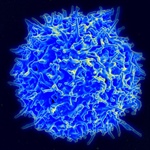 Identifican mutaciones que causan los linfomas periféricos de células T
