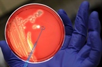 La miniproteína que avisa a las bacterias de las amenazas