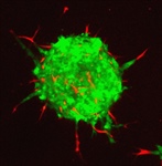 Células tumorales secuestran células sanas para promover la metástasis