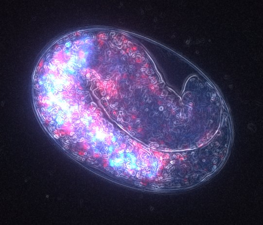 Gusano nematodo (Caenorhabditis elegans) con embriones en su interior y vitelo fluorescente.